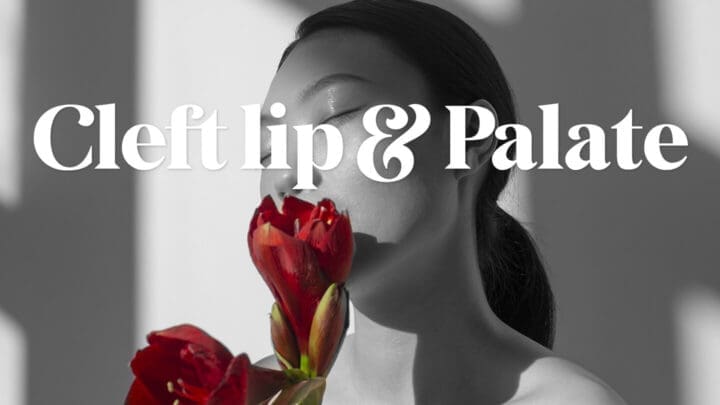 口唇口蓋裂コース